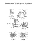 LOW PROFILE HEART VALVE AND DELIVERY SYSTEM diagram and image