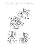 LOW PROFILE HEART VALVE AND DELIVERY SYSTEM diagram and image