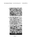 SHAPE-MEMORY-ACTUATED MATERIALS FOR ACCELERATED HEALING OF ORTHOPEDIC     INJURIES diagram and image