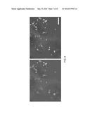 SHAPE-MEMORY-ACTUATED MATERIALS FOR ACCELERATED HEALING OF ORTHOPEDIC     INJURIES diagram and image