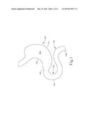 CONFORMING ANCHOR FOR DUODENAL BARRIER diagram and image