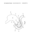 CONFORMING ANCHOR FOR DUODENAL BARRIER diagram and image