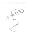 DELIVERY SYSTEM FOR OCULAR IMPLANT diagram and image