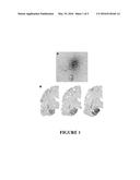 METHOD FOR PREVENTING AND/OR TREATING CHRONIC TRAUMATIC ENCEPHALOPATHY-II diagram and image