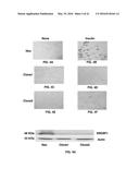 Methods and Compositions for the Treatment of Cancer and Related     Hyperproliferative Disorders diagram and image