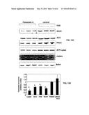 Methods and Compositions for the Treatment of Cancer and Related     Hyperproliferative Disorders diagram and image