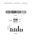 Methods and Compositions for the Treatment of Cancer and Related     Hyperproliferative Disorders diagram and image