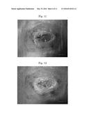 BIOLOGICAL FILM-FORMING AGENT FOR FACILITATION OF WOUND HEALING AND     COATING AND PROTECTION OF BIOLOGICAL ORGANS diagram and image