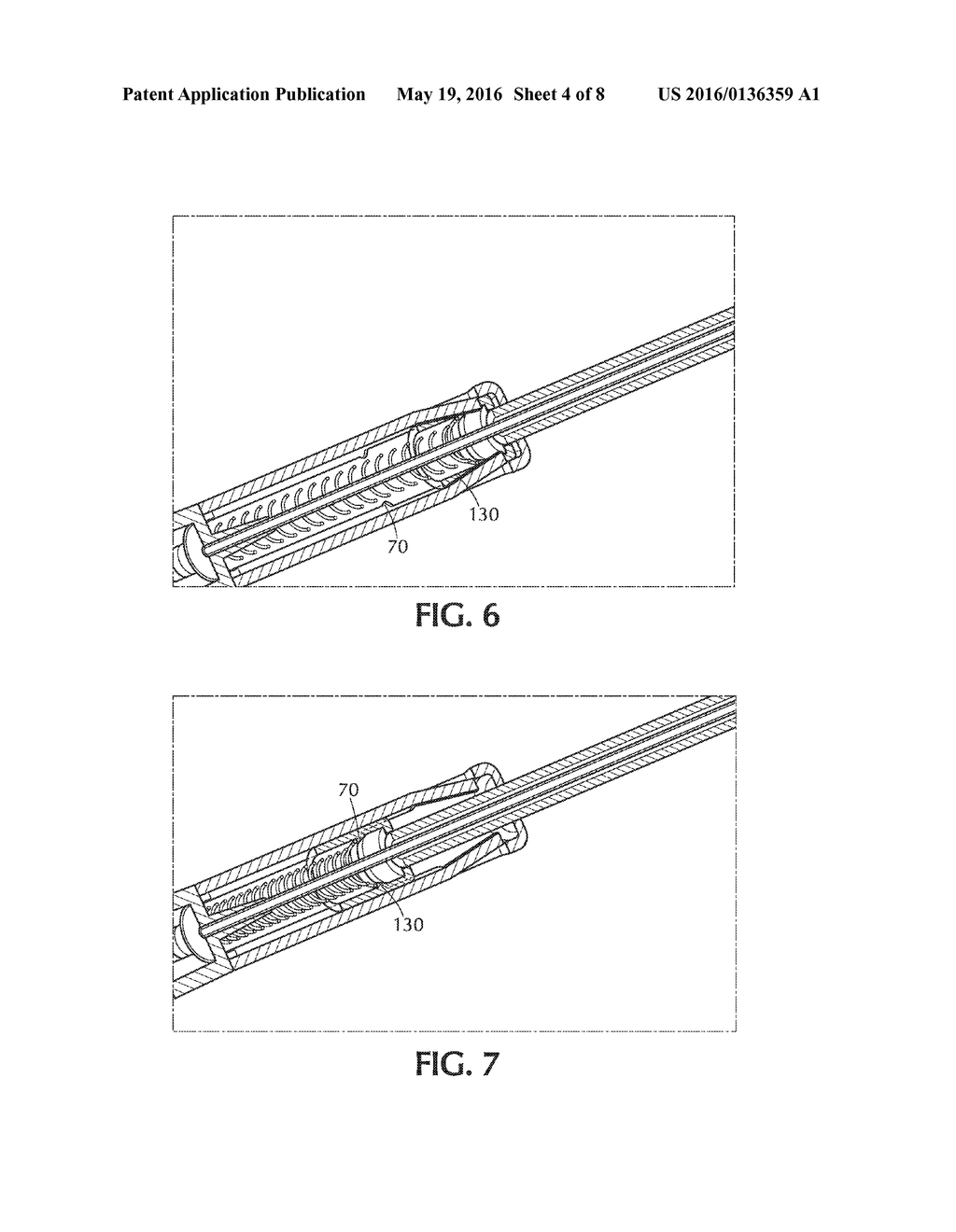 Retracting Sheath Detachable Safety Needle with Moving Spring - diagram, schematic, and image 05