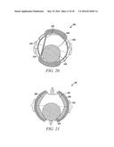 OSCILLATING POSITIVE EXPIRATORY PRESSURE DEVICE diagram and image