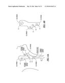 SYSTEM AND METHOD FOR MAPPING BARORECEPTORS diagram and image