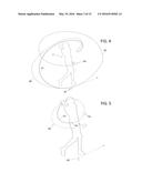 PERSONALIZED STROKE RECOGNITION ALGORITHM diagram and image