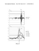 PERSONALIZED STROKE RECOGNITION ALGORITHM diagram and image