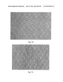 ZONAL PATTERNED APERTURED WEBS, LAMINATES, AND METHODS FOR MAKING THE SAME diagram and image