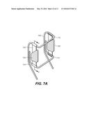 EXTERNAL ATTACHMENTS FOR SPEAKERS IN SEATS diagram and image