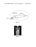 COMPOSITIONS AND METHODS FOR GLUCOSE TRANSPORT INHIBITION diagram and image