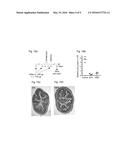 ANTIBODIES FOR PREVENTION AND TREATMENT OF DISEASES CAUSED BY CLOSTRIDIUM     DIFFICILE diagram and image