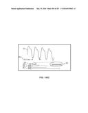 SYSTEMS AND METHODS FOR COLLISION COMPUTING FOR DETECTION AND NONINVASIVE     MEASUREMENT OF BLOOD GLUCOSE AND OTHER SUBSTANCES AND EVENTS diagram and image