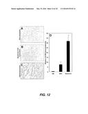 DETECTING CANCER WITH ANTI-CXCL16 AND ANTI-CXCR6 ANTIBODIES diagram and image