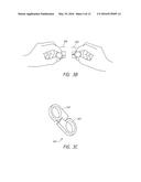 ADAPTERS FOR ATTACHING ACCESSORIES TO MOBILE ELECTRONIC DEVICES diagram and image