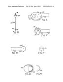 REMOTE MONITORING OF A PATIENT diagram and image