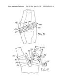 REMOTE MONITORING OF A PATIENT diagram and image