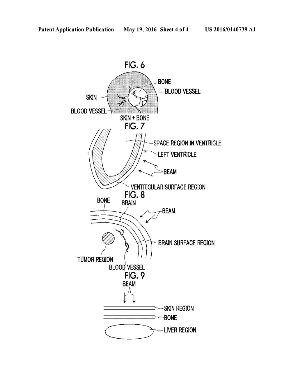 MEDICAL IMAGE DISPLAY CONTROL DEVICE, METHOD OF OPERATION FOR SAME, AND     MEDICAL IMAGE DISPLAY CONTROL PROGRAM - diagram, schematic, and image 05