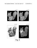 Constructing 3D Surfaces for Multi-Color Objects diagram and image