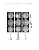 PLANT GROWTH-PROMOTING MICROORGANISMS AND METHODS OF USE THEREOF diagram and image