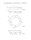 LOCKING CLIP AND ANCHOR ASSEMBLY FOR A TETHER diagram and image