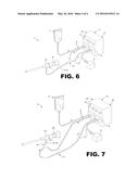 ADJUSTABLE ENDOSCOPE SHEATH diagram and image