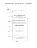 Visualization Catheters diagram and image