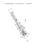 CATHETER WITH HIGH DENSITY ELECTRODE SPINE ARRAY diagram and image