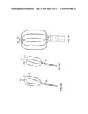 CATHETER WITH HIGH DENSITY ELECTRODE SPINE ARRAY diagram and image