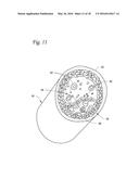 ULTRASOUND IMAGE FORMATION AND/OR RECONSTRUCTION USING MULTIPLE FREQUENCY     WAVEFORMS diagram and image