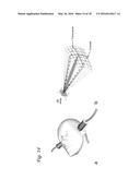 ULTRASOUND IMAGE FORMATION AND/OR RECONSTRUCTION USING MULTIPLE FREQUENCY     WAVEFORMS diagram and image