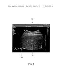 ELASTOGRAPHY MEASUREMENT SYSTEM AND METHOD diagram and image