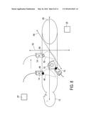 ELASTOGRAPHY MEASUREMENT SYSTEM AND METHOD diagram and image