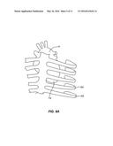 METHOD AND APPARATUS FOR TRANSAPICAL ACCESS AND CLOSURE diagram and image