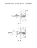 METHOD AND APPARATUS FOR TRANSAPICAL ACCESS AND CLOSURE diagram and image