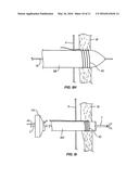 METHOD AND APPARATUS FOR TRANSAPICAL ACCESS AND CLOSURE diagram and image