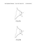 PROBE, TREATMENT DEVICE, AND TREATMENT SYSTEM diagram and image