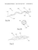 CLOT RETRIEVAL DEVICE FOR REMOVING OCCLUSIVE CLOT FROM A BLOOD VESSEL diagram and image