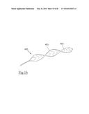 CLOT RETRIEVAL DEVICE FOR REMOVING OCCLUSIVE CLOT FROM A BLOOD VESSEL diagram and image