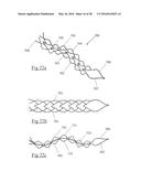 CLOT RETRIEVAL DEVICE FOR REMOVING OCCLUSIVE CLOT FROM A BLOOD VESSEL diagram and image