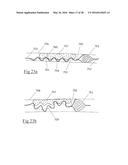 CLOT RETRIEVAL DEVICE FOR REMOVING OCCLUSIVE CLOT FROM A BLOOD VESSEL diagram and image