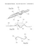 CLOT RETRIEVAL DEVICE FOR REMOVING OCCLUSIVE CLOT FROM A BLOOD VESSEL diagram and image