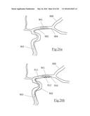 CLOT RETRIEVAL DEVICE FOR REMOVING OCCLUSIVE CLOT FROM A BLOOD VESSEL diagram and image