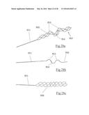 CLOT RETRIEVAL DEVICE FOR REMOVING OCCLUSIVE CLOT FROM A BLOOD VESSEL diagram and image