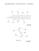 CLOT RETRIEVAL DEVICE FOR REMOVING OCCLUSIVE CLOT FROM A BLOOD VESSEL diagram and image